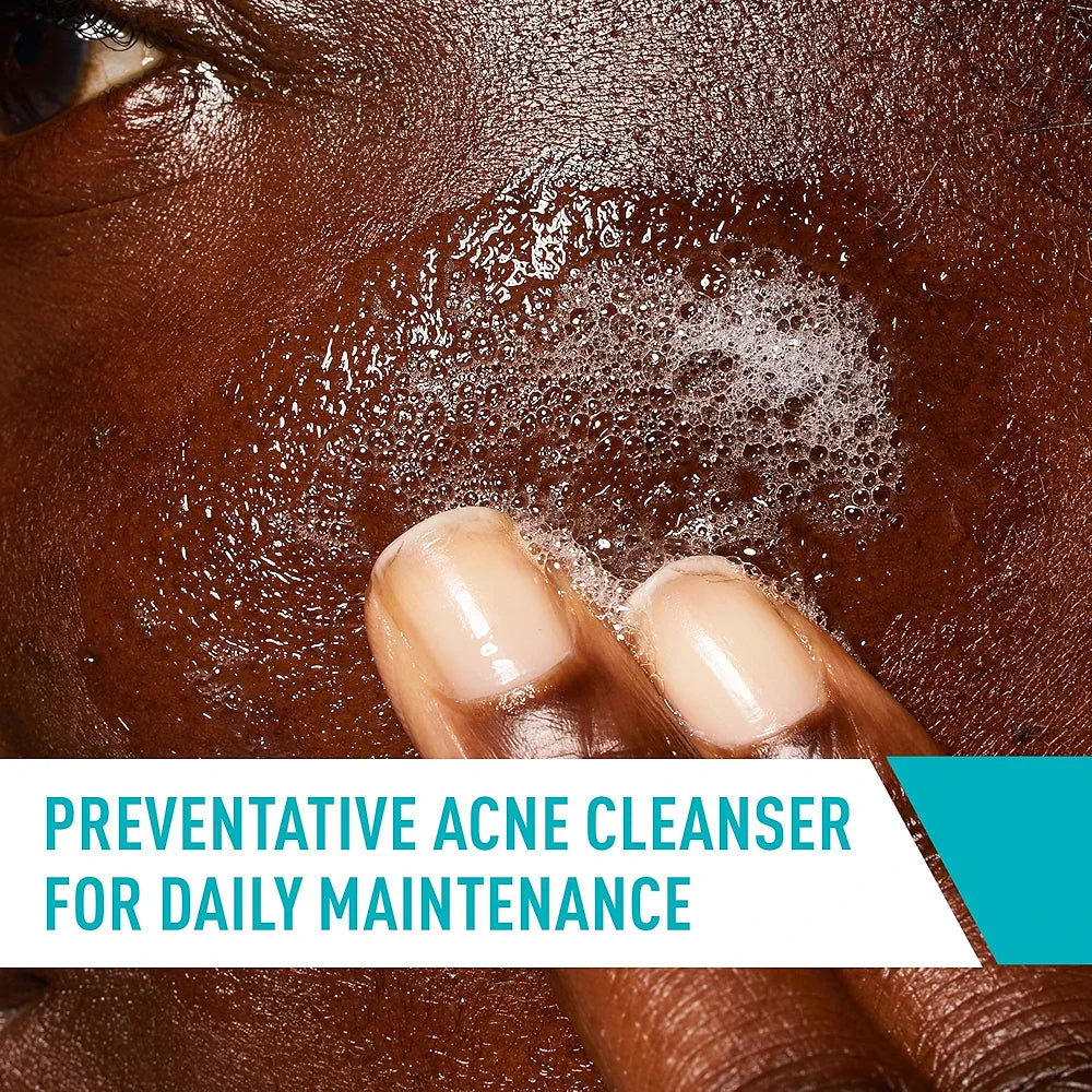 CeraVe Face Wash Acne Treatment Salicylic Acid Cleanser with Purifying Clay for Oily Skin Blackhead Remover and Clogged Pore Control 8 Ounce, multi, 8 Fl Oz, 237 ml